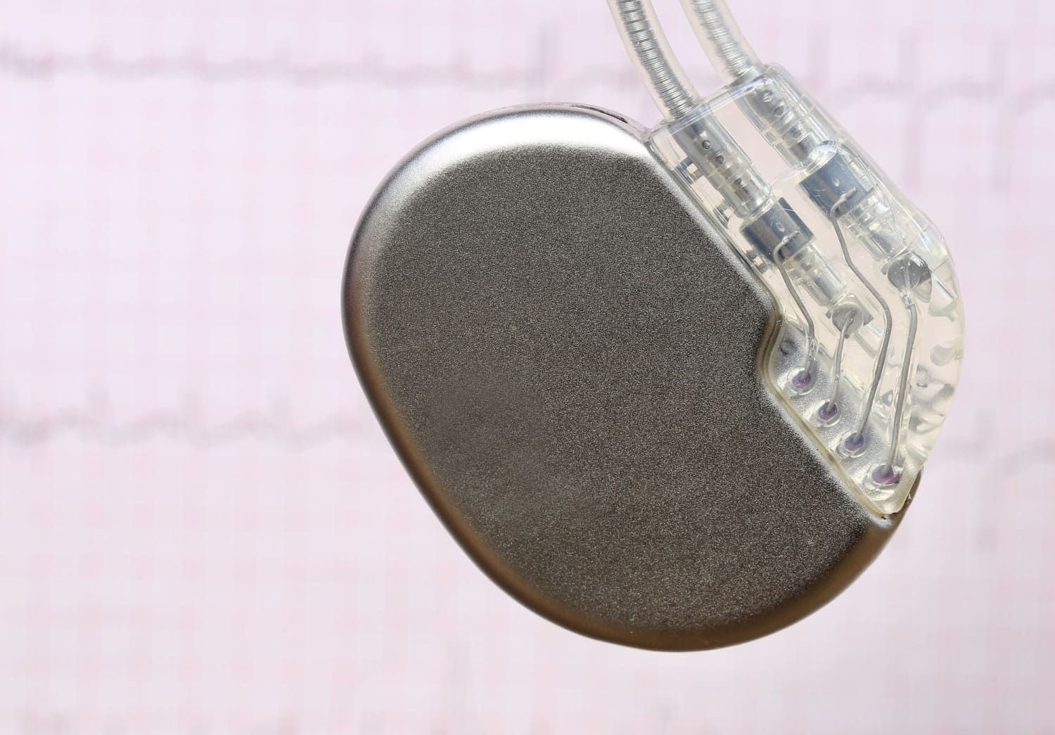 Consulta de marcapasos en Uruapan: Cuidado Especializado para tu Corazón