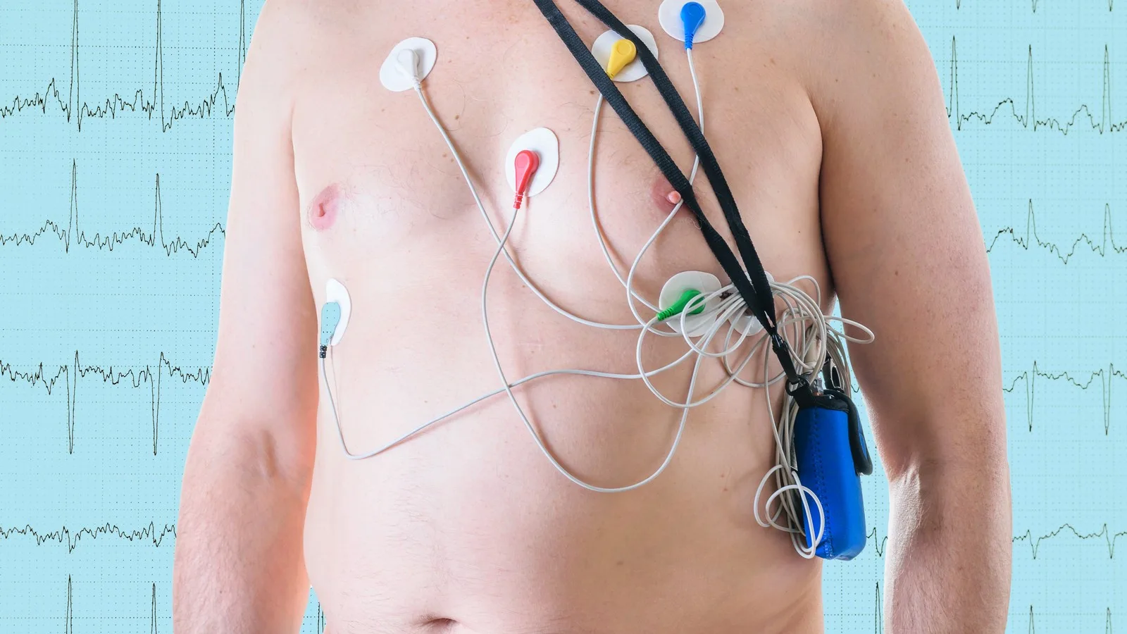 ¿Dónde realizarse un estudio holter cerca de Morelia, Michoacán?