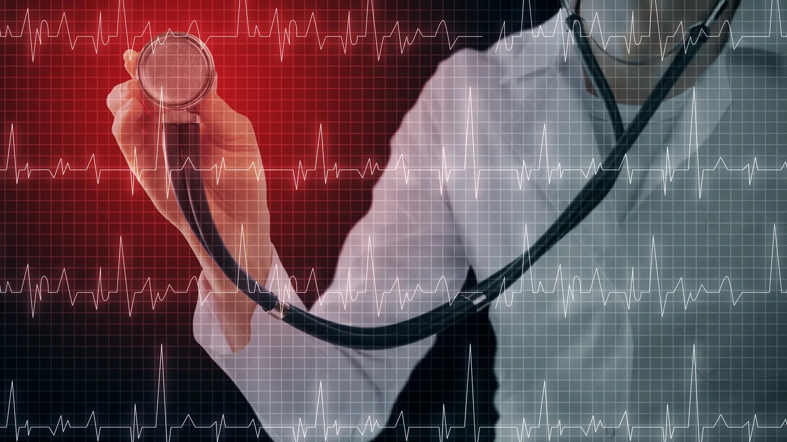 ¿Qué médico trata latidos lentos o pausas en el corazón?