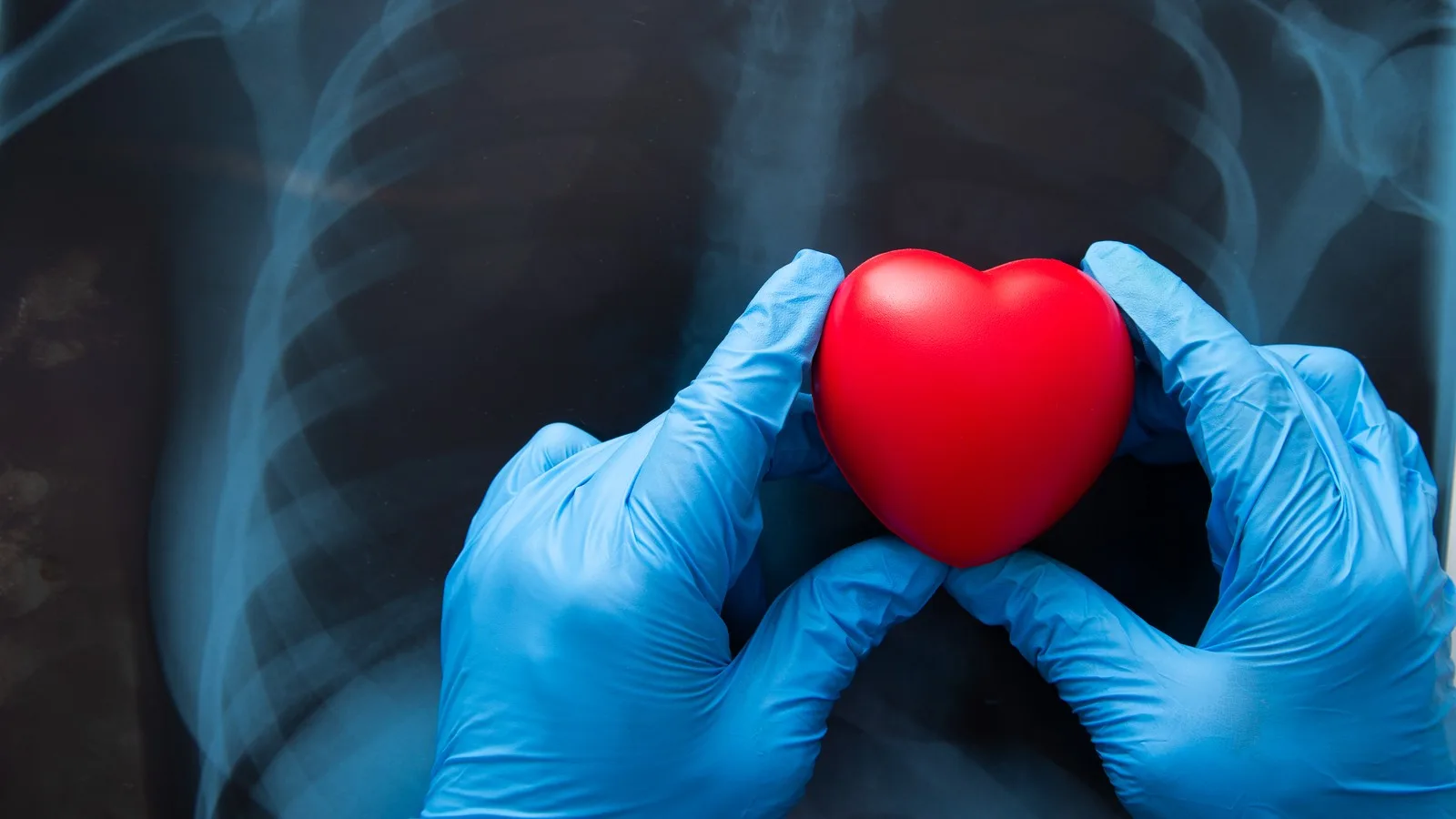 ¿Qué médico trata pericarditis?